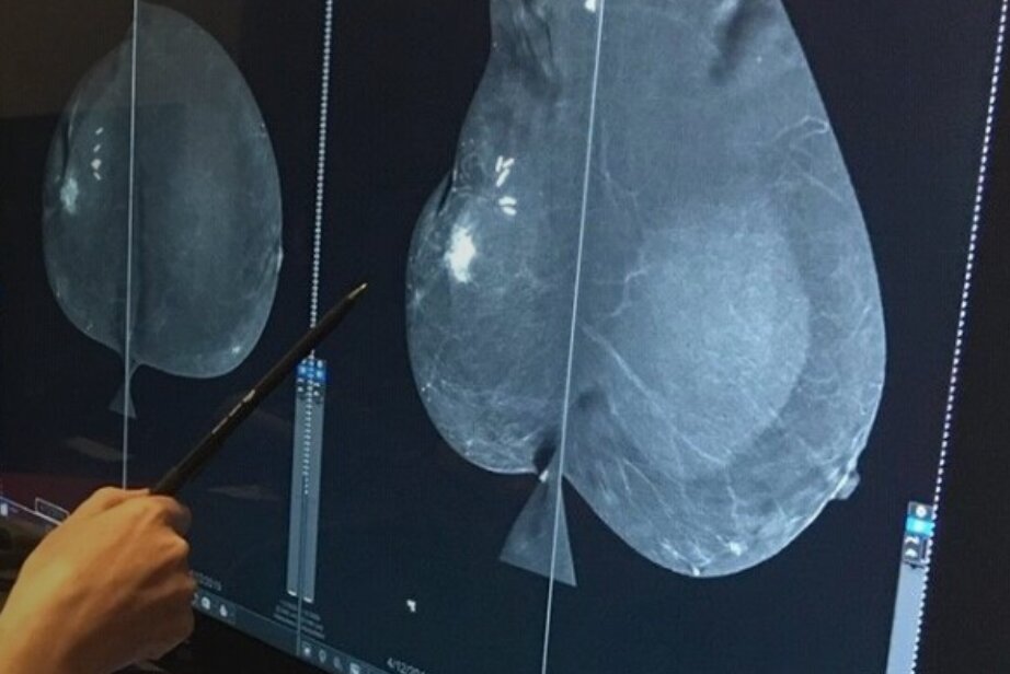 MMC technology adds new element to breast exams | Las Cruces Bulletin